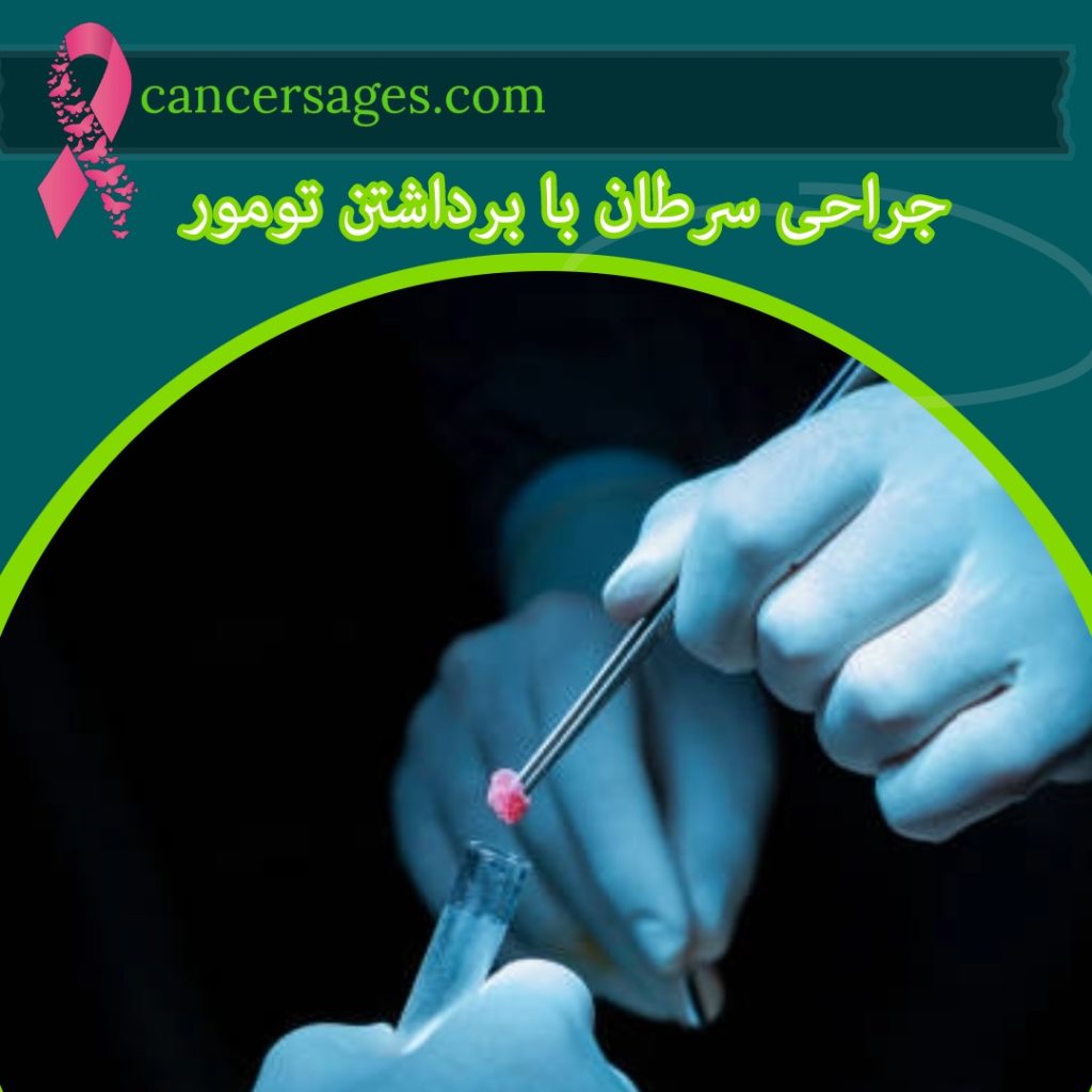 جراحی سرطان با برداشتن تومور
