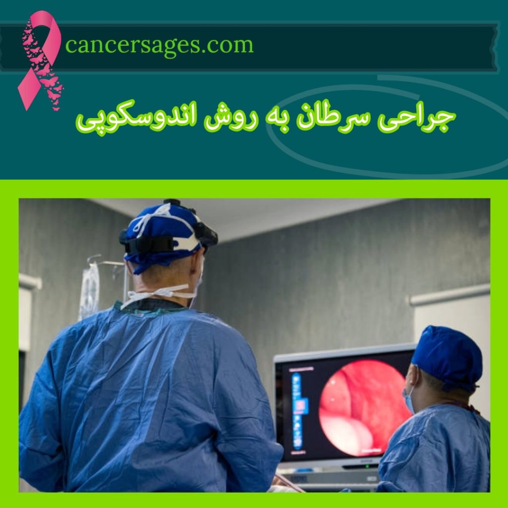 جراحی سرطان به روش آندوسکوپی