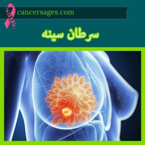 سرطان سینه