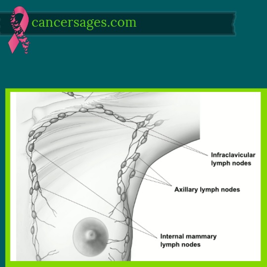 گره های لنفاوی در ارتباط با پستان