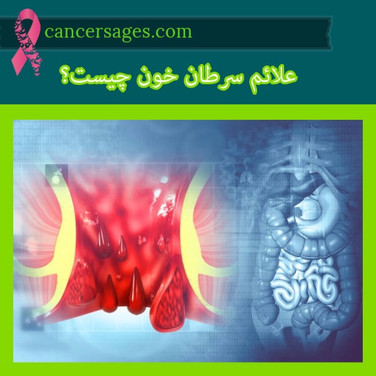 علائم سرطان خون چیست