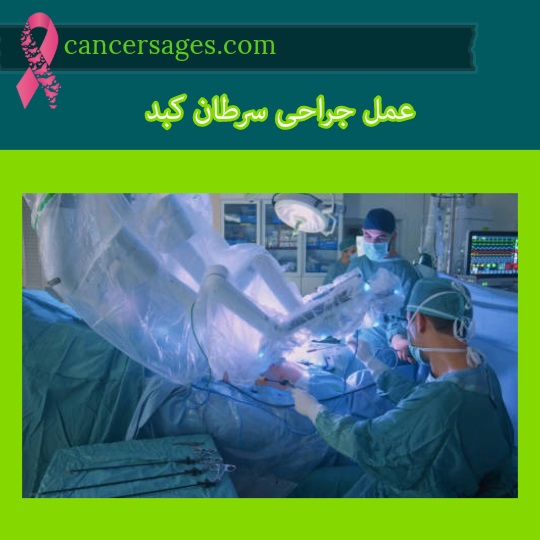 عمل جراحی سرطان کبد
