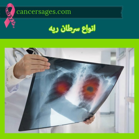 انواع سرطان ریه