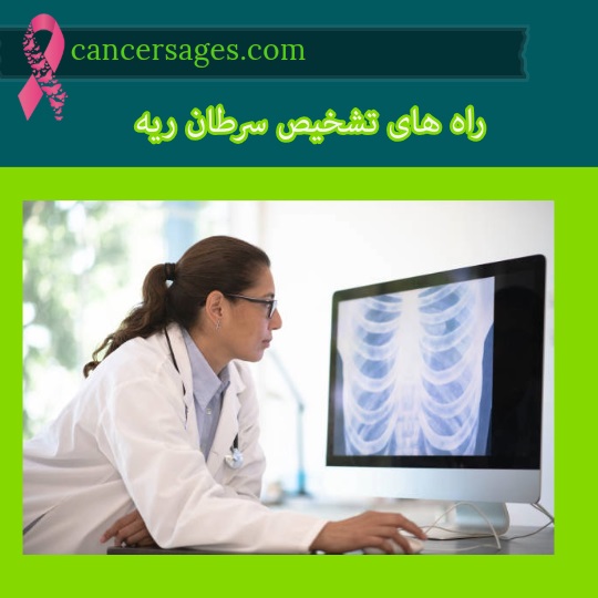راه های تشخیص سرطان ریه