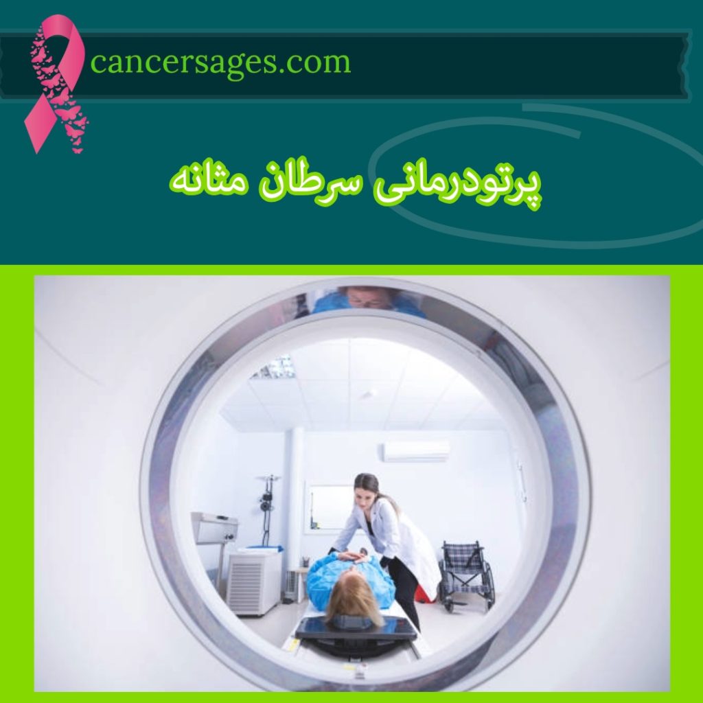 پرتودرمانی سرطان مثانه