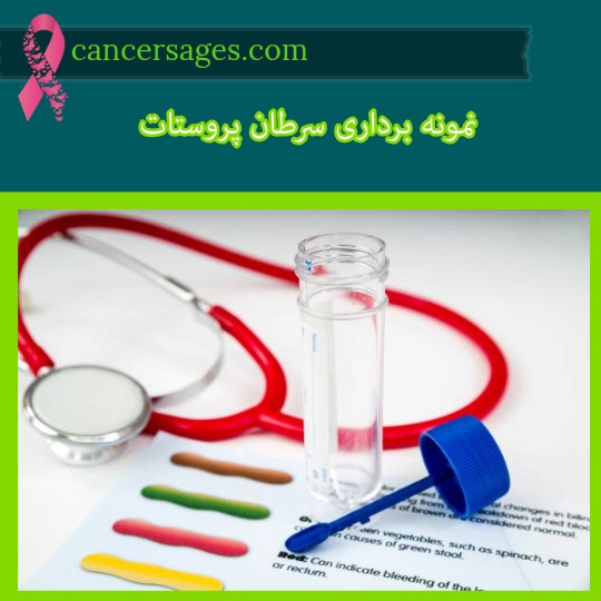 نمونه برداری سرطان پروستات