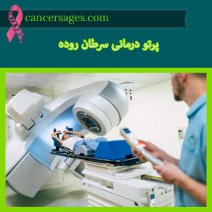 پرتودرمانی چیست و چگونه انجام میشود؟ (راهنمای بیماران 1404) 43 پرتو درمانی سرطان روده