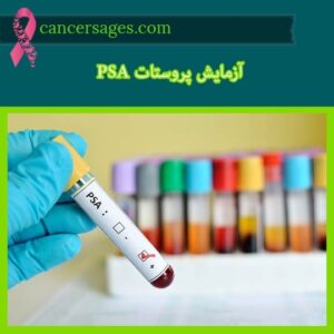 رنج نرمال آزمایش psa در سرطان پروستات چقدر است؟