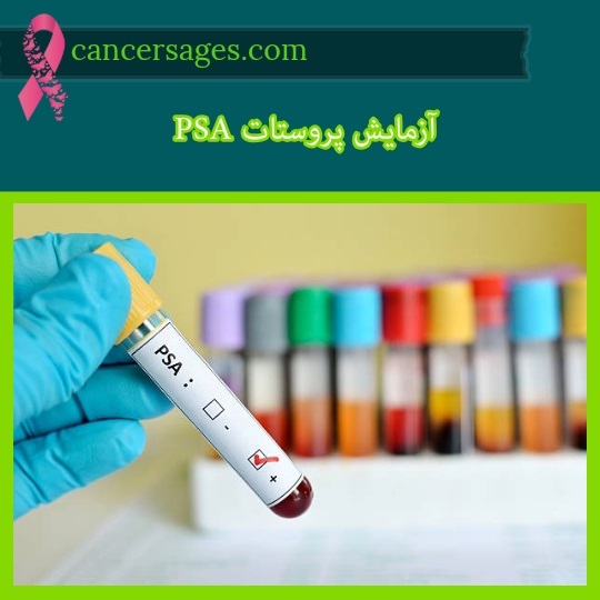 رنج نرمال آزمایش psa در سرطان پروستات چقدر است؟