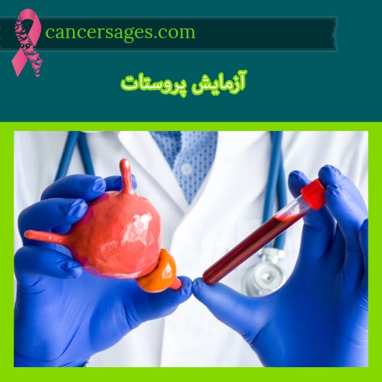 آزمایش پروستات