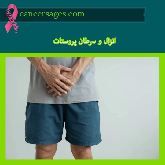 انزال و سرطان پروستات