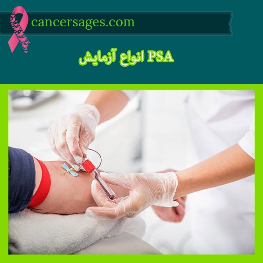 انواع آزمایش PSA