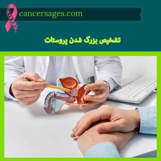 تشخیص بزرگ شدن پروستات