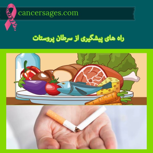 راه های پیشگیری از سرطان پروستات