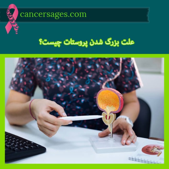 علت بزرگ شدن پروستات چیست؟ | دشمن پروستات