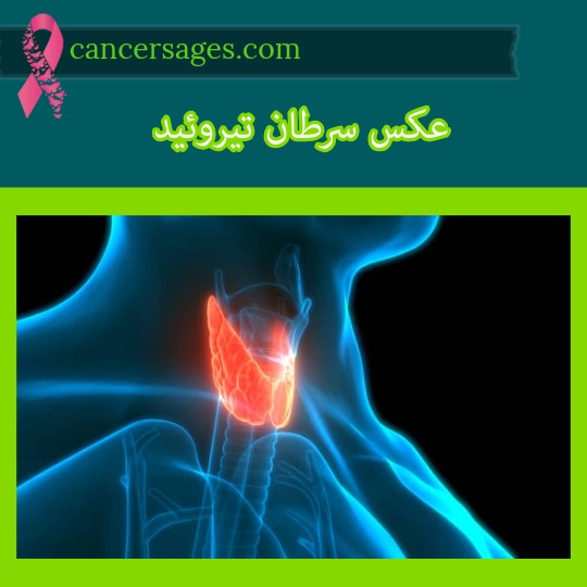 عکس سرطان تیروئید