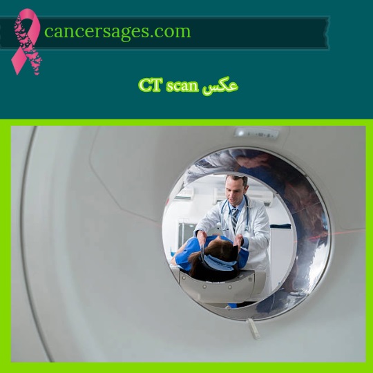 CT scan عکس