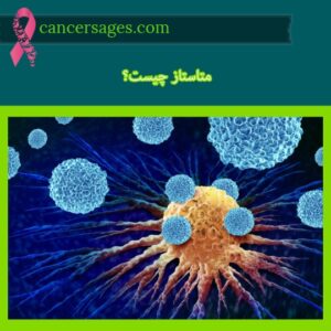 متاستاز چیست؟