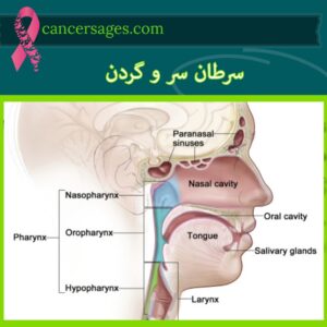 سرطان سر و گردن