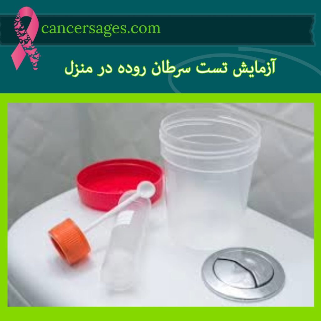 آزمایش تست سرطان روده در منزل