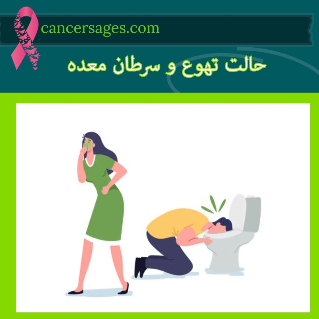 حالت تهوع و سرطان معده