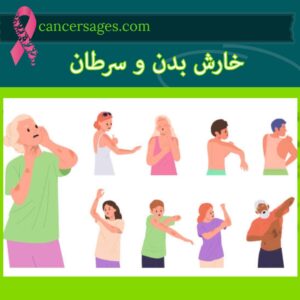 سرطان پوست چیست؟ علائم (با عکس)، انواع و درمان 17 خارش بدن و سرطان