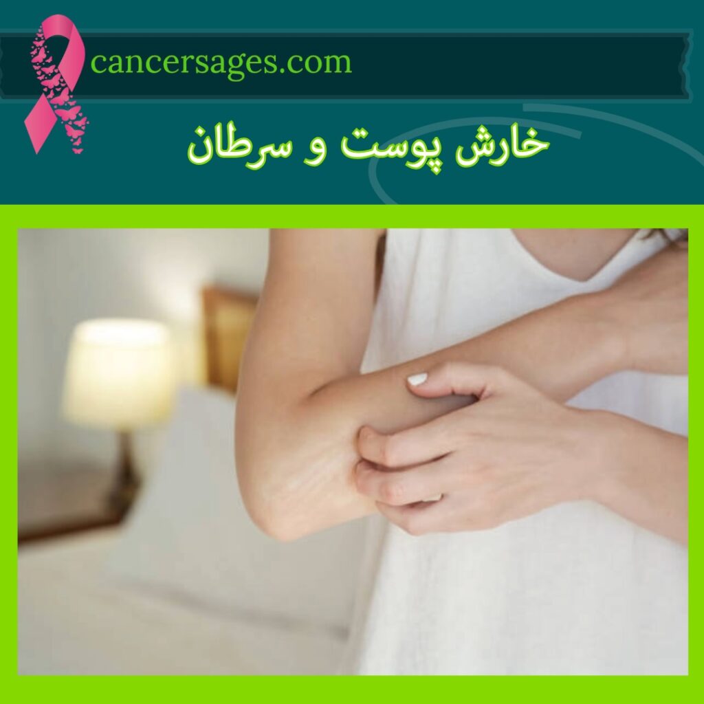 خارش پوست و سرطان
