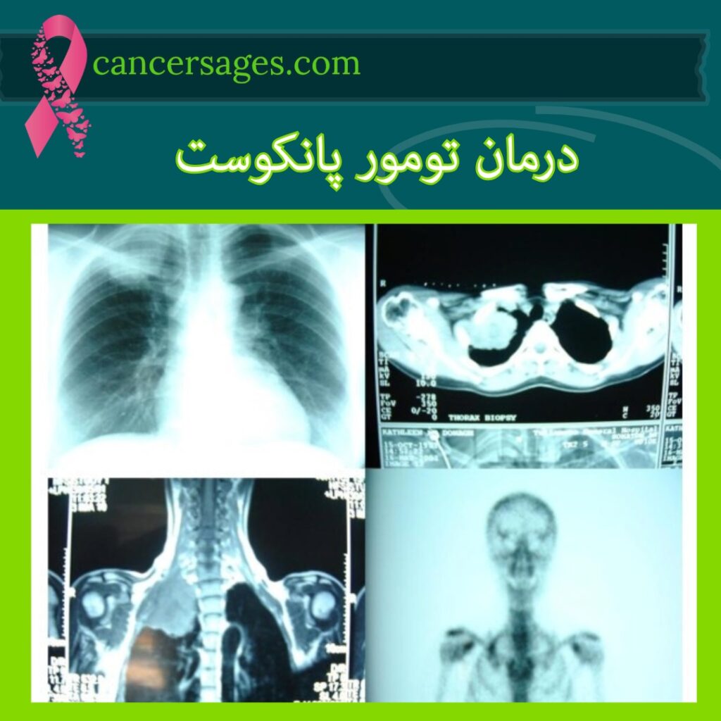 درمان تومور پانکوست