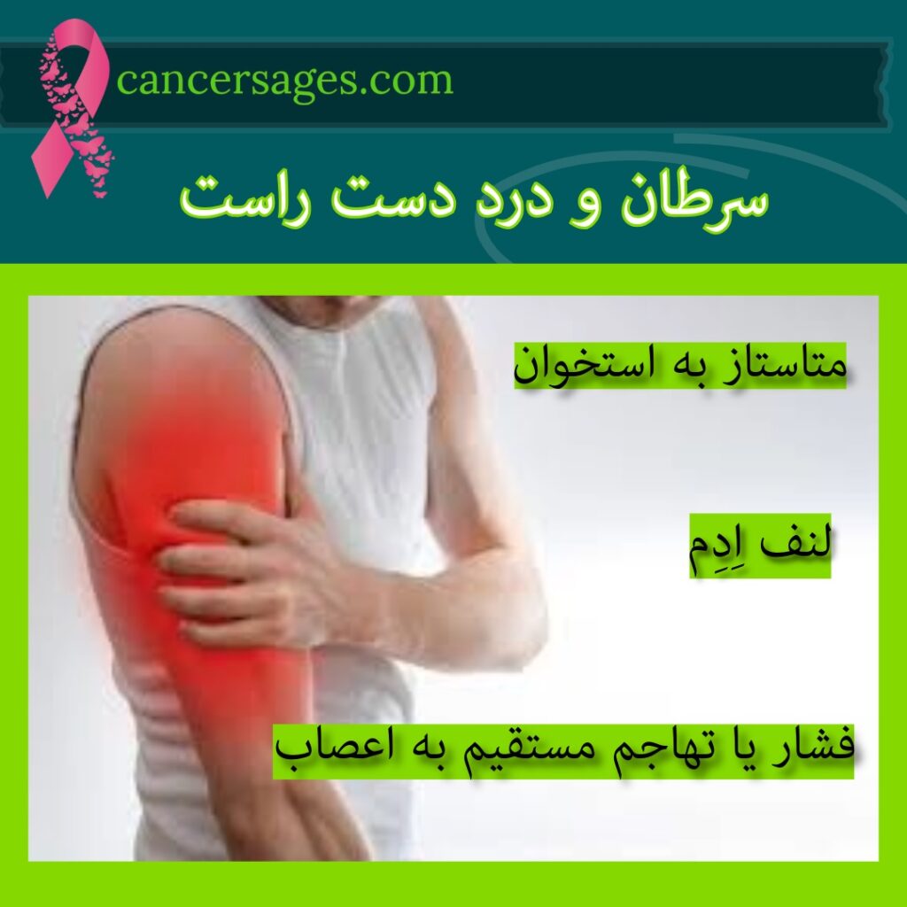 سرطان و درد دست راست