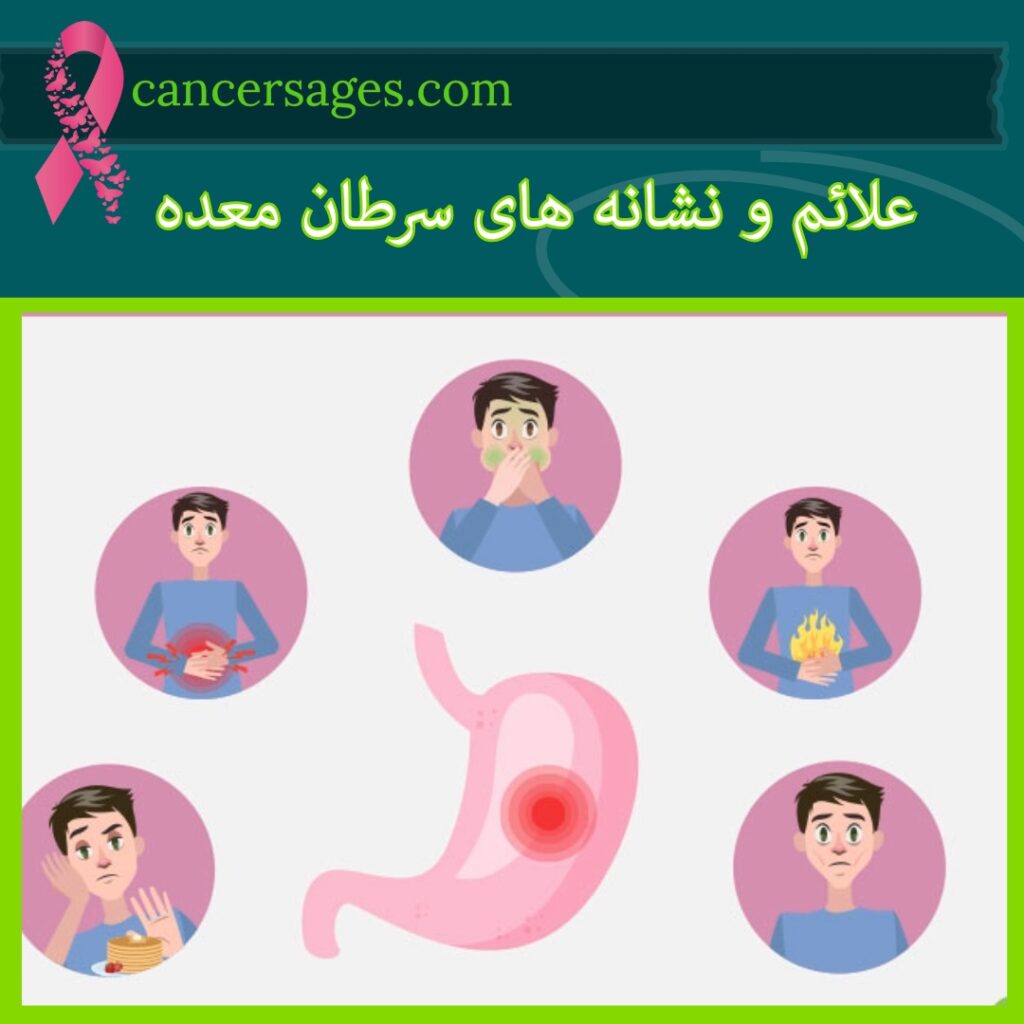 علائم و نشانه های سرطان معده