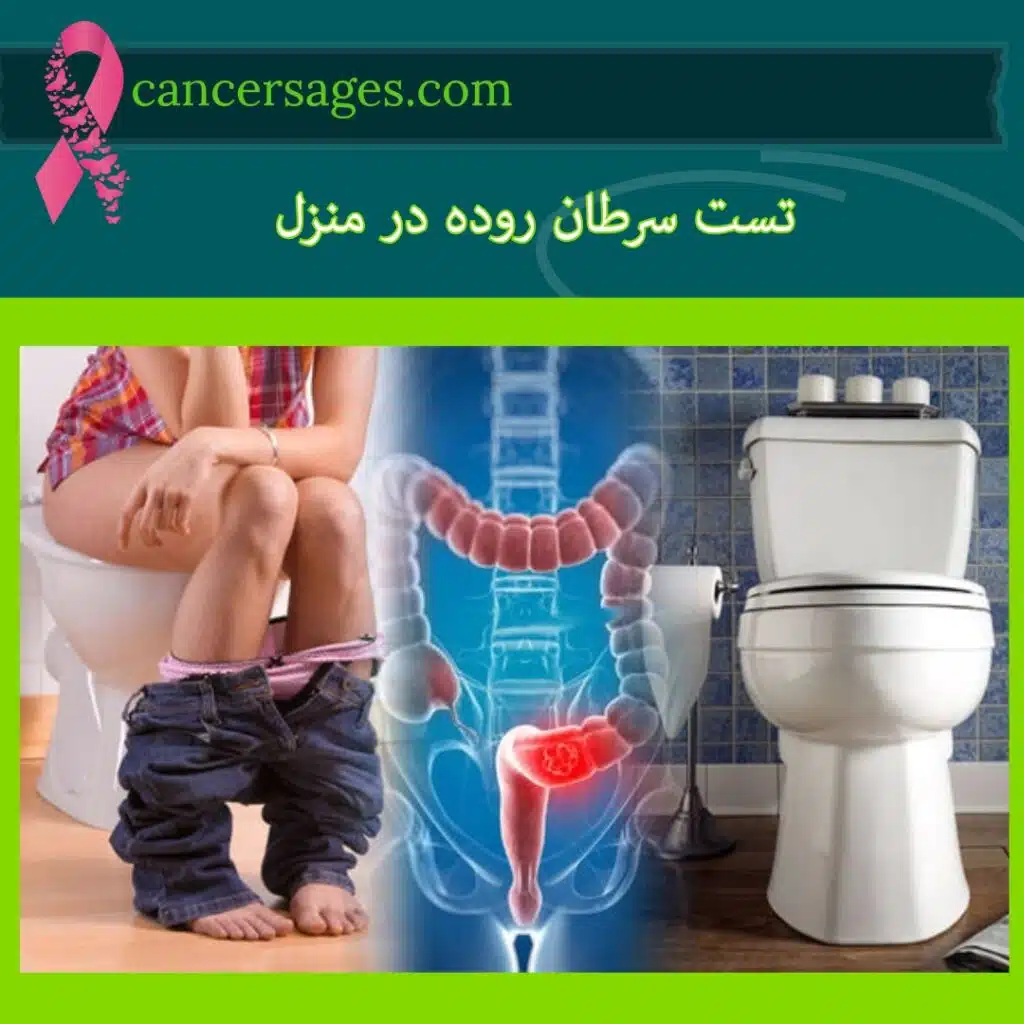 تست سرطان روده در منزل