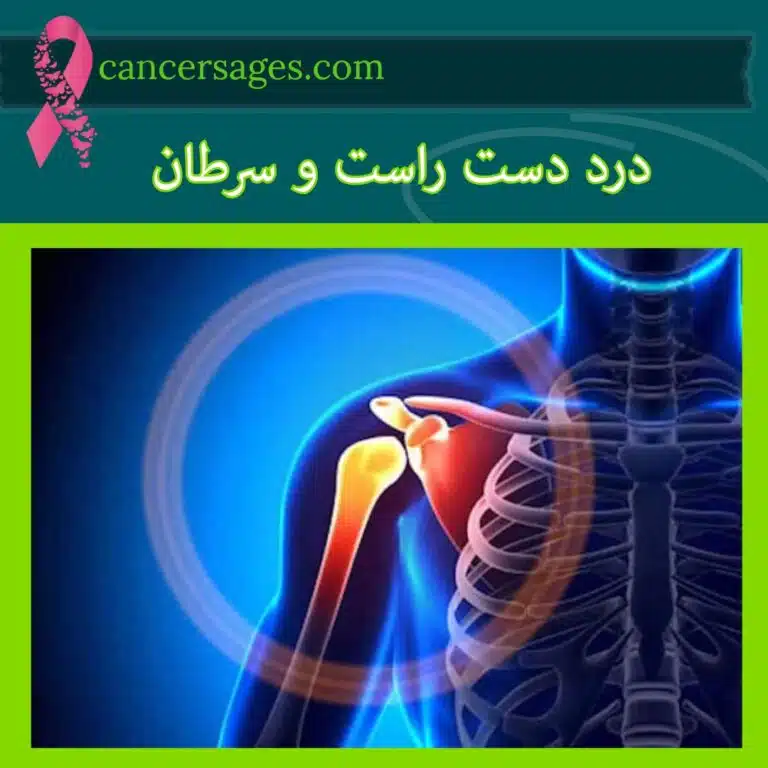 درد دست راست و سرطان: آیا میتواند نشانهای از سرطان باشد؟ 1 درد دست راست و سرطان