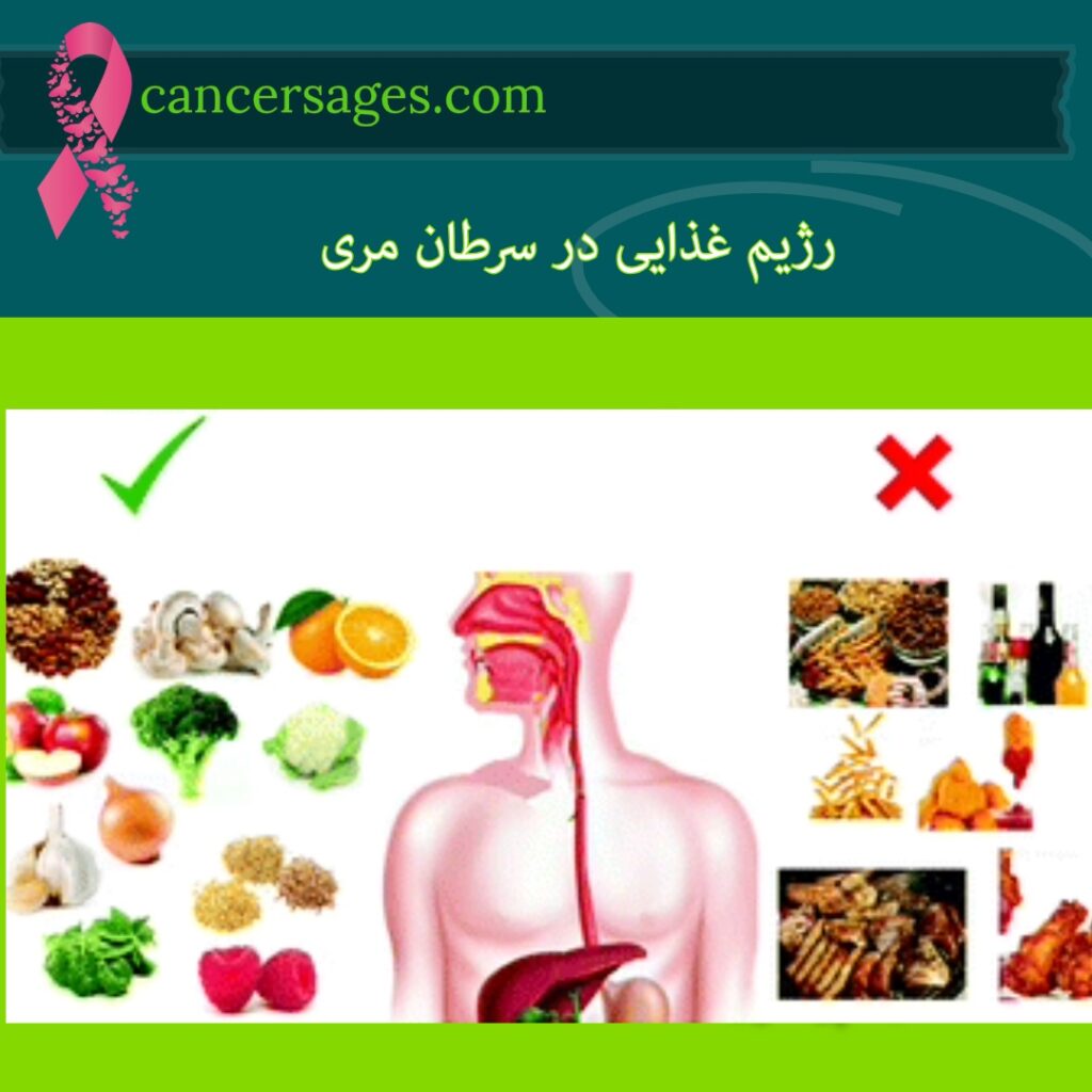 رژیم غذایی در سرطان مری