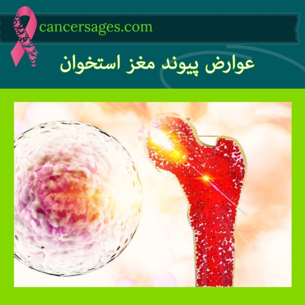 عوارض پیوند مغز استخوان