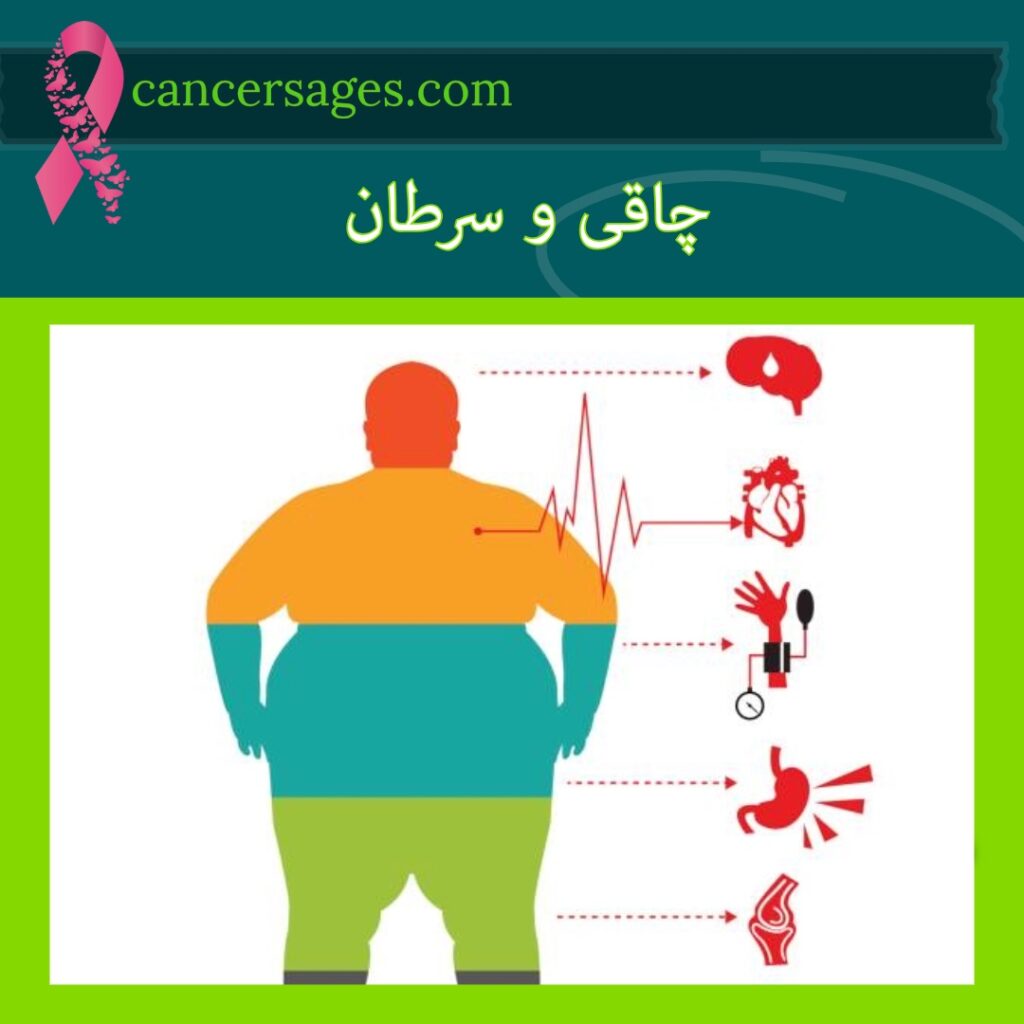 چاقی و سرطان