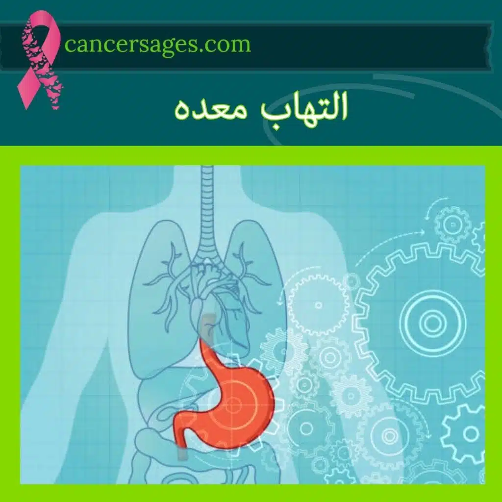 التهاب معده