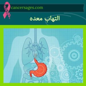 التهاب معده