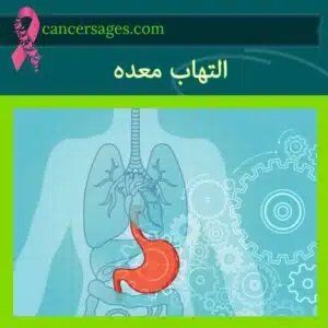 التهاب معده