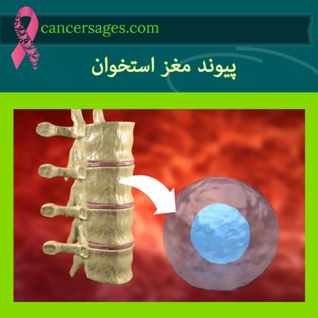 پیوند مغز استخوان