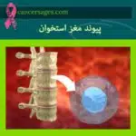 پیوند مغز استخوان