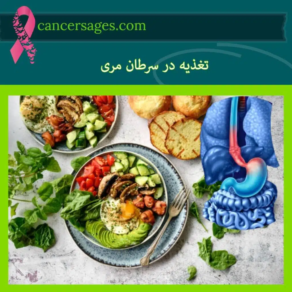 تغذیه در سرطان مری
