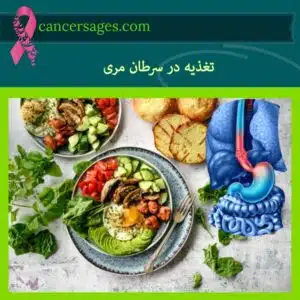 تغذیه در سرطان مری