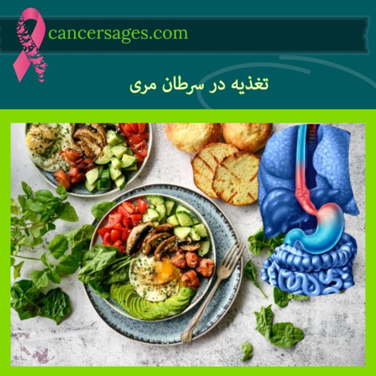تغذیه در سرطان مری