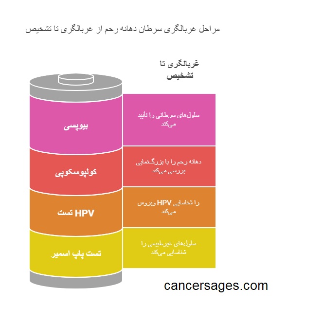 تشخیص سرطان دهانه رحم