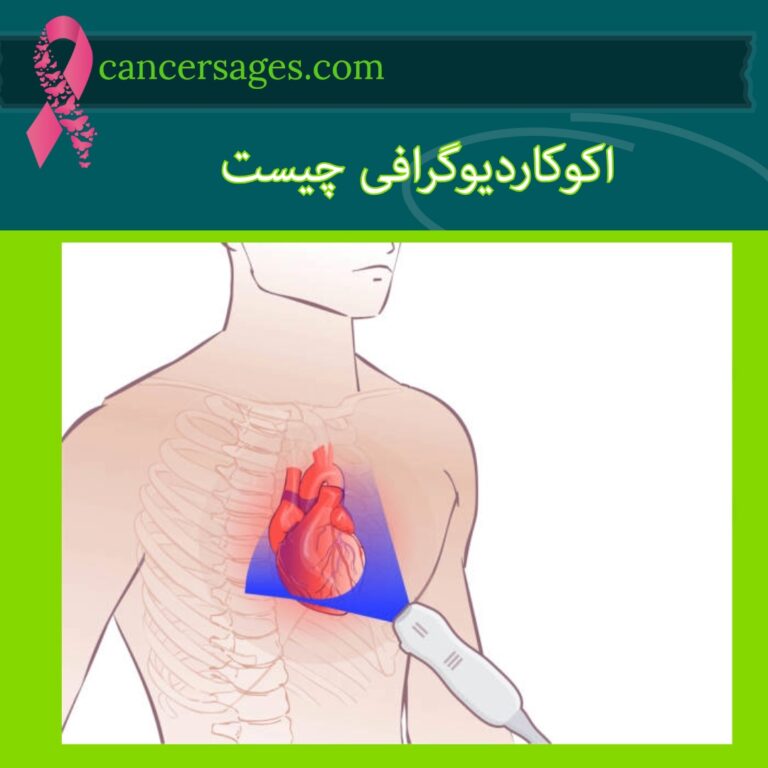 اکوکاردیوگرافی چیست