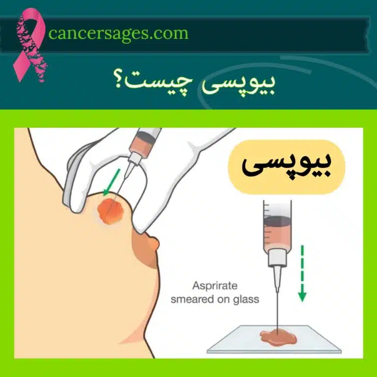 بیوپسی چیست؟