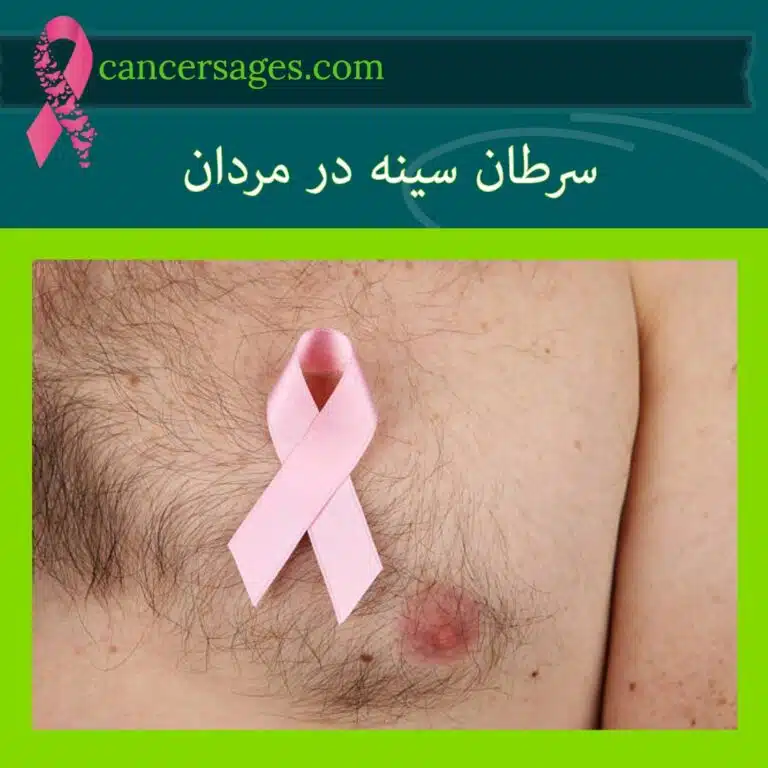 سرطان سینه در مردان: علائم، تشخیص و درمان 1 سرطان سینه در مردان