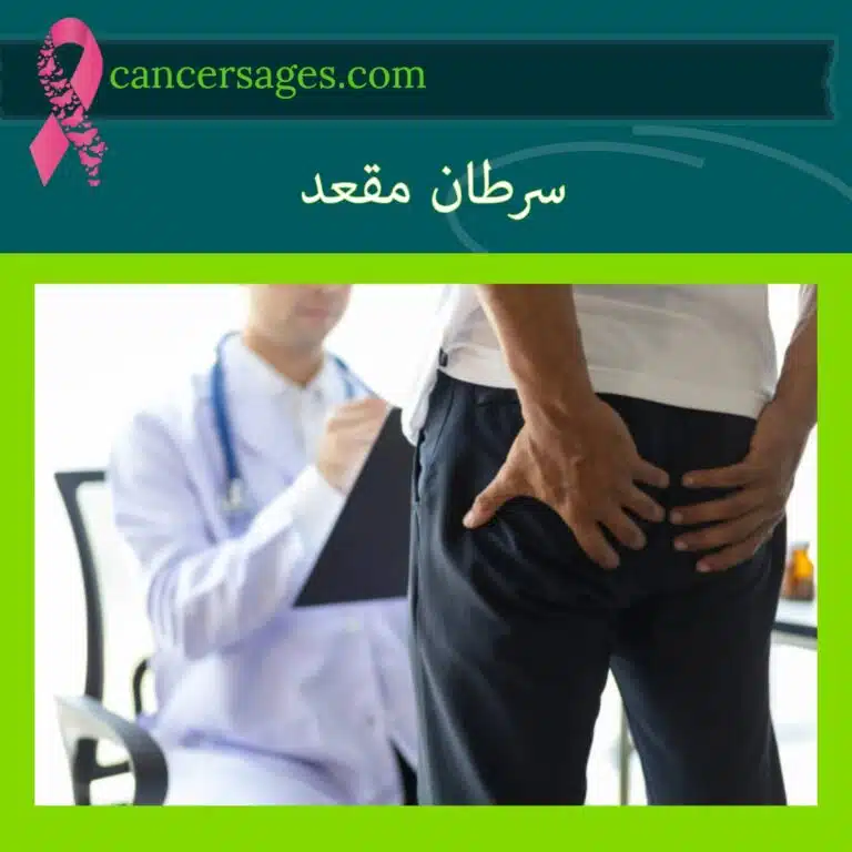 سرطان مقعد