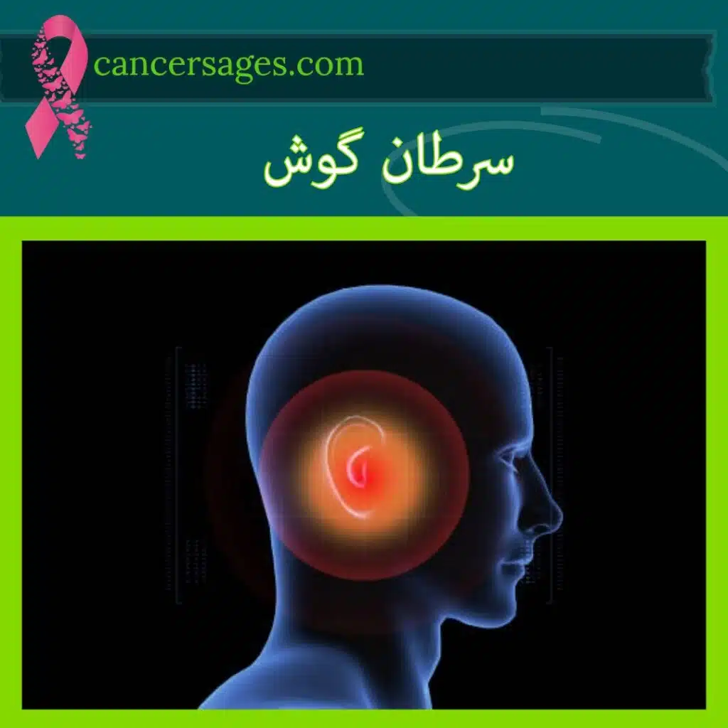 سرطان گوش