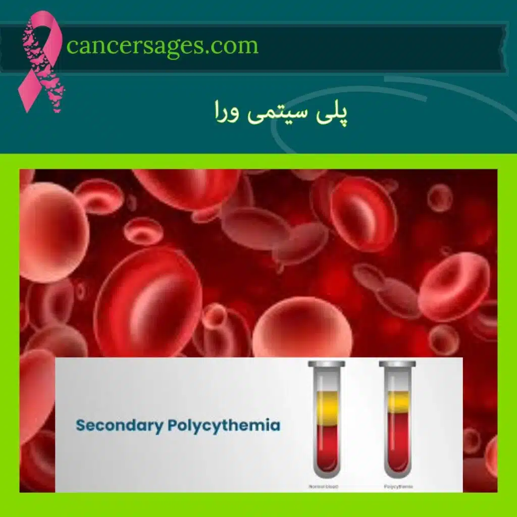 پلی سیتمی ورا